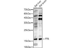 Western blot analysis of extracts of various cell lines, using TTR antibody (ABIN3021473, ABIN3021474, ABIN3021475 and ABIN6215107) at 1:500 dilution. (TTR antibody  (AA 21-147))