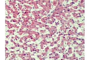 Human Liver: Formalin-Fixed, Paraffin-Embedded (FFPE) (IRAK4 antibody  (N-Term))