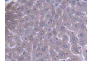 DAB staining on IHC-P; Samples: Mouse Liver Tissue (ACAA1 antibody  (AA 182-424))