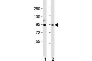 Western Blotting (WB) image for anti-Prospero Homeobox 1 (PROX1) (AA 492-520) antibody (ABIN3032345)