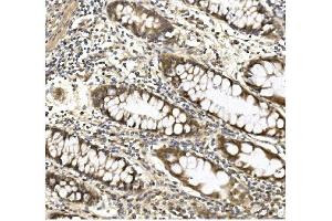 IHC analysis of Aconitase 1/ACO1 using anti-Aconitase 1/ACO1 antibody (ABIN7598988). (Aconitase 1 antibody  (AA 1-137))