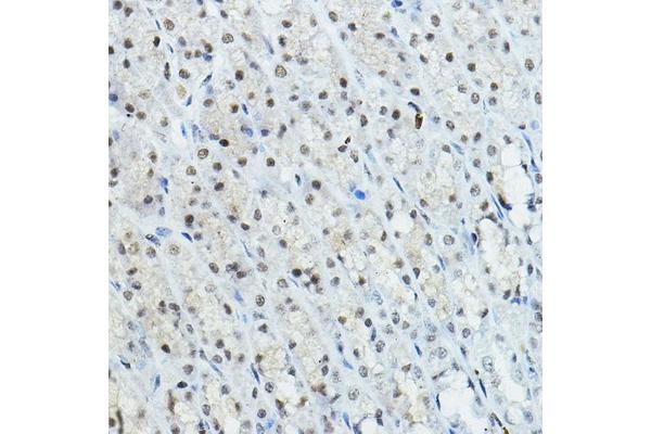 NCOR1 antibody  (AA 1-200)