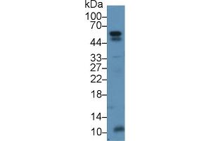 Detection of ANGPTL2 in Mouse Stomach lysate using Polyclonal Antibody to Angiopoietin Like Protein 2 (ANGPTL2) (ANGPTL2 antibody  (AA 267-493))