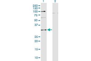 Western Blot analysis of C10orf63 expression in transfected 293T cell line by C10orf63 monoclonal antibody (M05), clone 3E8.