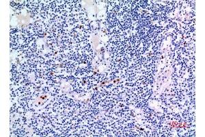 Immunohistochemistry (IHC) analysis of paraffin-embedded Human Lymph Gland, antibody was diluted at 1:100. (IDH3A antibody  (Internal Region))