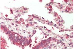 Human, Lung: Foramlin-Fixed Paraffin-Embedded (FFPE) (NFATC4 antibody  (N-Term))