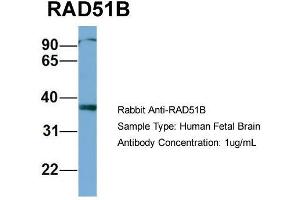 Host: Rabbit  Target Name: RAD51B  Sample Tissue: Human Fetal Brain  Antibody Dilution: 1. (RAD51 Homolog B antibody  (Middle Region))