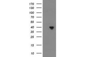 HEK293T cells were transfected with the pCMV6-ENTRY control (Left lane) or pCMV6-ENTRY DNAJB1 (Right lane) cDNA for 48 hrs and lysed. (DNAJB1 antibody)