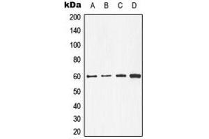 Western blot analysis of CDC25C expression in A431 (A), MCF7 (B), mouse kidney (C), rat heart (D) whole cell lysates. (CDC25C antibody  (Center))