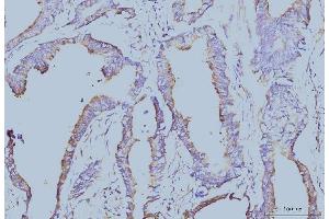 IHC analysis of EIF4A1 using anti-EIF4A1 antibody (ABIN7603144). (EIF4A1 antibody  (N-Term))