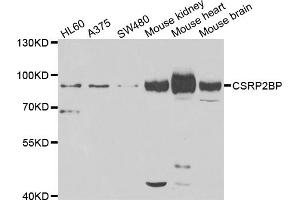 Western blot analysis of extracts of various cell lines, using CSRP2BP antibody. (CSRP2BP antibody)