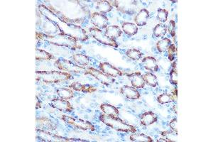 Immunohistochemistry of paraffin-embedded mouse kidney using LONP1 Rabbit pAb (ABIN1680707, ABIN3018785, ABIN3018786 and ABIN6220576) at dilution of 1:100 (40x lens). (LONP1 antibody  (AA 120-400))