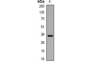 Western blot analysis of Pinch-1 expression in HepG2 (A) whole cell lysates. (LIMS1 antibody)