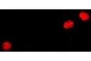 Immunofluorescent analysis of GADD45 alpha staining in A549 cells. (GADD45A antibody)