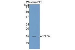 Detection of Recombinant DAO, Human using Polyclonal Antibody to Amiloride Binding Protein 1 (ABP1) (DAO antibody  (AA 347-466))