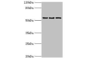 Western blot All lanes: ARFGAP3 antibody at 4 μg/mL Lane 1: HepG2 whole cell lysate Lane 2: Jurkat whole cell lysate Lane 3: A549 whole cell lysate Secondary Goat polyclonal to rabbit IgG at 1/10000 dilution Predicted band size: 57, 52 kDa Observed band size: 57 kDa (ARFGAP3 antibody  (AA 217-516))