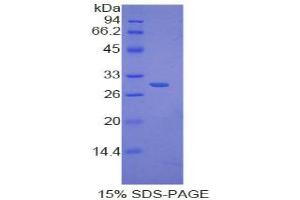 SDS-PAGE analysis of Human IkBd Protein. (IkBd Protein)