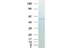 Embryonic Ectoderm Development (EED) (Transcript Variant 1) protein (Myc-DYKDDDDK Tag)