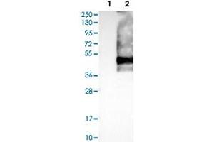 Western Blot analysis of Lane 1: negative control (vector only transfected HEK293T cell lysate) and Lane 2: over-expression lysate (co-expressed with a C-terminal myc-DDK tag in mammalian HEK293T cells) with SSTR2 polyclonal antibody . (SSTR2 antibody)
