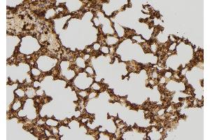 ABIN6277609 at 1/100 staining Mouse lung tissue by IHC-P.