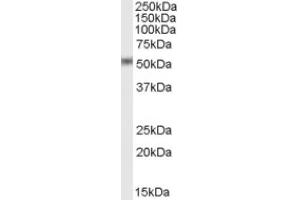 Image no. 1 for anti-STEAP Family Member 4 (STEAP4) (C-Term) antibody (ABIN375107)