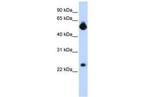 Image no. 1 for anti-Notch 4 (NOTCH4) (Internal Region) antibody (ABIN6742248) (NOTCH4 antibody  (Internal Region))
