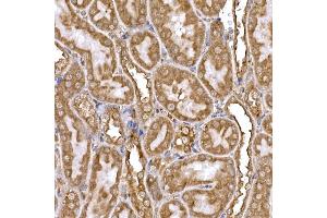 Immunohistochemistry of paraffin-embedded rat kidney using DYNC1LI2 Rabbit pAb (ABIN7266863) at dilution of 1:25 (40x lens). (DYNC1LI2 antibody)