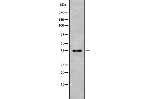 Western blot analysis of Peropsin using HeLa whole cell lysates (Peropsin antibody  (Internal Region))