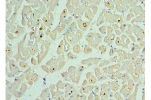 Immunohistochemistry of paraffin-embedded human heart tissue using ABIN7145306 at dilution of 1:100 (BCL2L13 antibody  (AA 1-300))