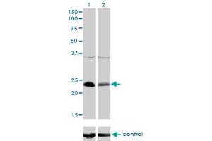Western blot analysis of NFYB over-expressed 293 cell line, cotransfected with NFYB Validated Chimera RNAi (Lane 2) or non-transfected control (Lane 1).