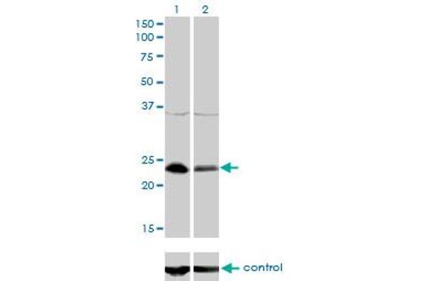 NFYB Antikörper  (AA 1-207)