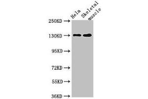 Western Blot Positive WB detected in: Hela whole cell lysate, Mouse skeletal muscle tissue All lanes: PER3 antibody at 4 μg/mL Secondary Goat polyclonal to rabbit IgG at 1/50000 dilution Predicted band size: 132, 133 kDa Observed band size: 132 kDa (PER3 antibody  (AA 1-131))