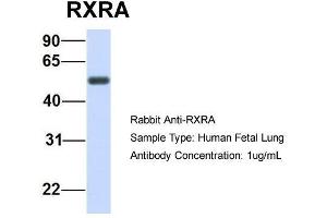Host:  Rabbit  Target Name:  RXRA  Sample Type:  Human Fetal Lung  Antibody Dilution:  1. (Retinoid X Receptor alpha antibody  (N-Term))