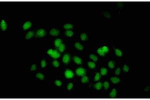 Immunofluorescence staining of Hela cells with ABIN7149530 at 1:233, counter-stained with DAPI. (DND1 antibody  (AA 37-180))