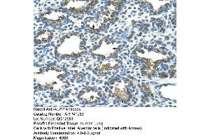 Rabbit Anti-ALPP Antibody  Paraffin Embedded Tissue: Human Lung Cellular Data: Alveolar cells Antibody Concentration: 4. (PLAP antibody  (C-Term))