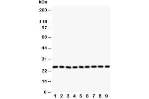 Western blot testing of SOD2 antibody and Lane 1:  rat liver;  2: (r) intestine;  3: (r) lung;  4: (r) heart;  5: human SMMC-7721;  6: (h) HeLa;  7: (h) COLO320;  8: (h) SW620;  9: (h) A549 cell lysate.