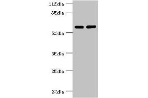 PPP2R5C antibody  (Regulatory Subunit Gamma)