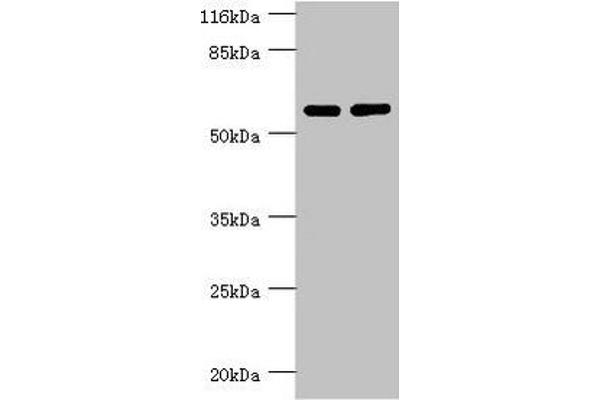 PPP2R5C antibody  (Regulatory Subunit Gamma)