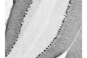 Cerebellum immunohistochemistry.