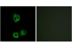 Immunofluorescence analysis of HeLa cells, using Lck (Phospho-Tyr393) Antibody. (LCK antibody  (pTyr394))