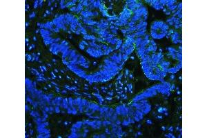 IF analysis of Integrin beta 4/ITGB4 using anti-Integrin beta 4/ITGB4 antibody (ABIN7601135).