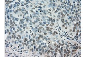 Immunohistochemical staining of paraffin-embedded Ovary tissue using anti-STK39mouse monoclonal antibody. (STK39 antibody)
