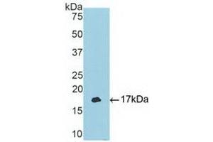 Detection of Recombinant TBX3, Human using Polyclonal Antibody to T-Box Protein 3 (TBX3) (TBX3 antibody  (AA 107-220))