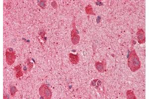 Immunohistochemistry (IHC) image for anti-Solute Carrier Family 17 (Acidic Sugar Transporter), Member 5 (SLC17A5) (N-Term) antibody (ABIN2781631)