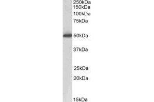 Western Blotting (WB) image for anti-Acid Phosphatase, Prostate (ACPP) (Internal Region) antibody (ABIN2464573)