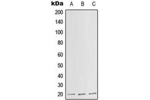 Western blot analysis of SLC25A11 expression in HepG2 (A), Raw264. (SLC25A11 antibody  (Center))