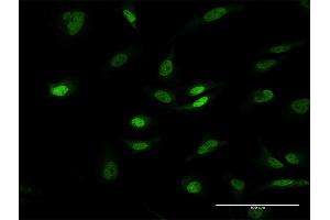Immunofluorescence of purified MaxPab antibody to PHC1 on HeLa cell. (PHC1 antibody  (AA 1-957))