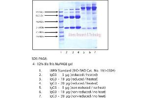 Gel Scan of Immunoglobulin G3 (IgG3), Normal Human Plasma  This information is representative of the product ART prepares, but is not lot specific. (IgG3 Protein)