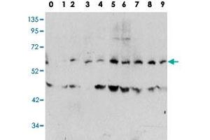 Western blot analysis of MYC (phospho T58) polyclonal antibody  in human TPA activated HeLa cell line lysates. (c-MYC antibody  (pThr58))