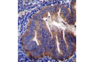 Immunohistochemistry analysis in formalin fixed and paraffin embedded human uterus tissue reacted with KLC2 Antibody (N-term) followed which was  peroxidase conjugated to the secondary antibody and followed by DAB staining. (KLC2 antibody  (N-Term))
